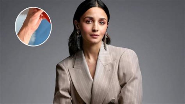 Alia Shawkat Arm Scar Has “Arrested Development” Fans Confused