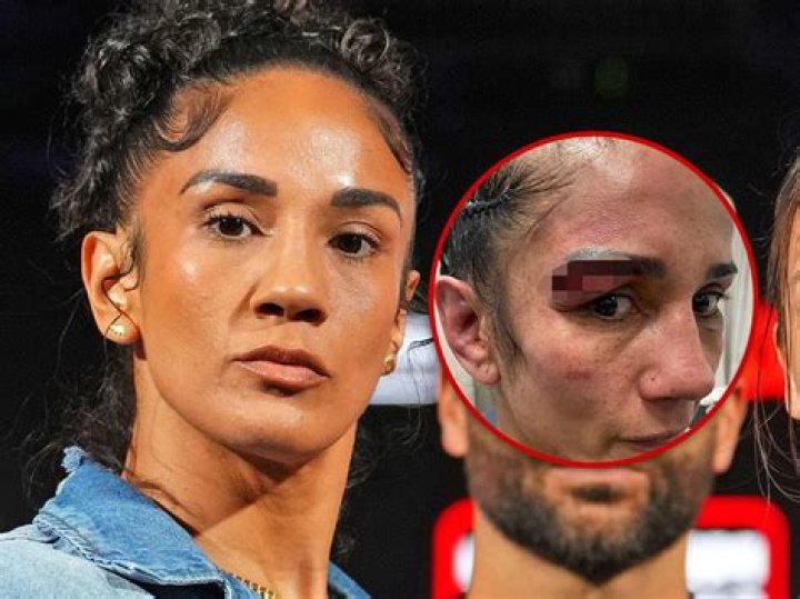 Amanda Serrano's Health / Injury Update: What happened to Amanda Serrano? - SarkariResult