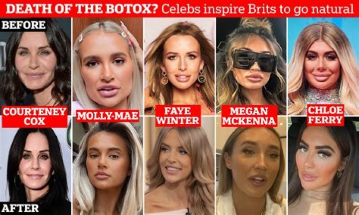 Did Alex Greenwood Get Her Lips Done? Botox and Plastic Surgery Photo