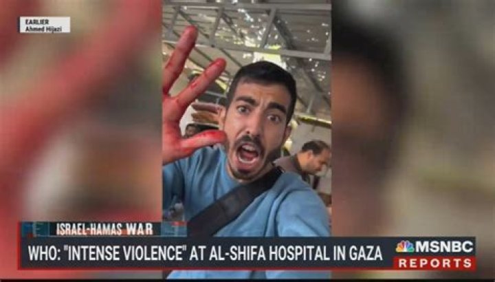 Hamas Crisis Actor Ibrahim : Who is He ? Tiktoker from Gaza Accused of Simulating Injuries in Propaganda Videos - SarkariResult